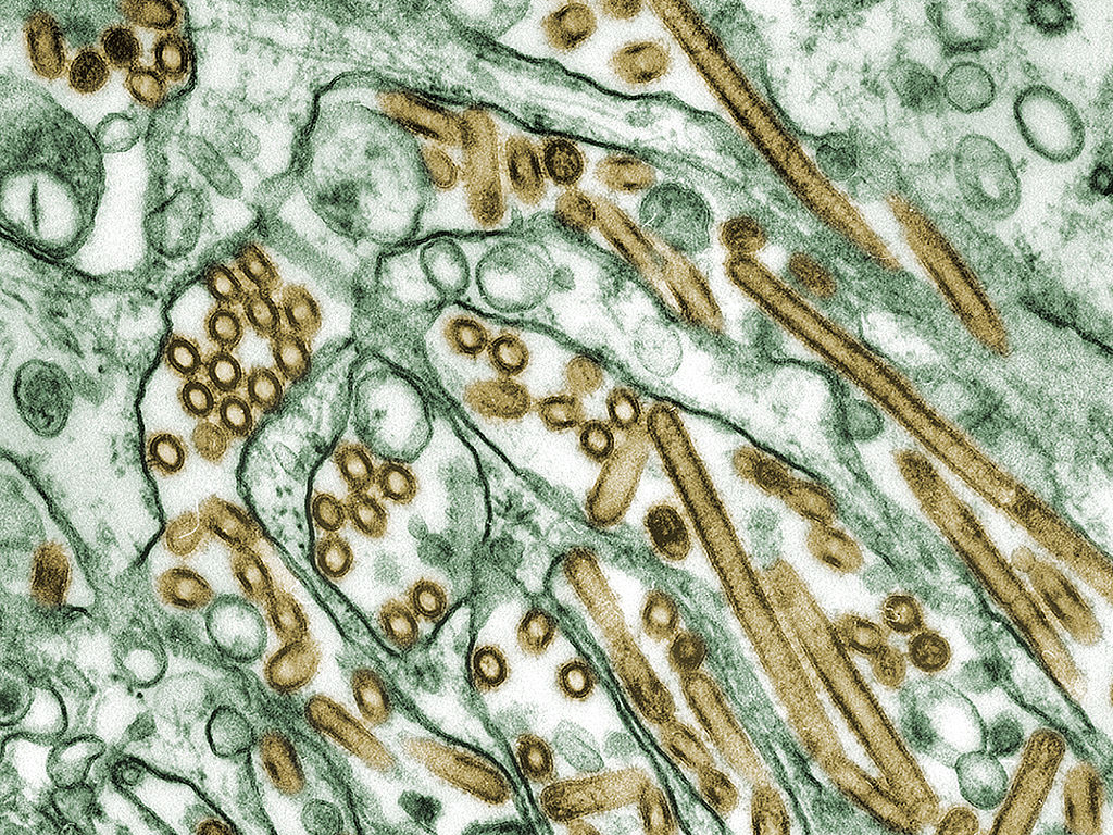 Picture of bird flu virus